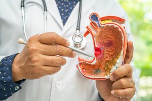 8 Early Warning Signs of Sto.mach Can.cer: See a Doctor If You Have Even One