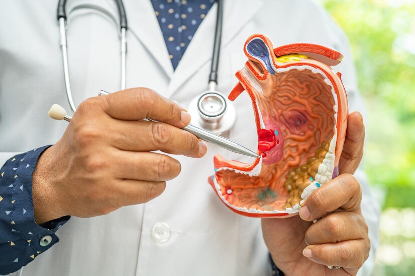 8 Early Warning Signs of Sto.mach Can.cer: See a Doctor If You Have Even One